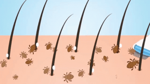 Tire os piolhos com pente fino.