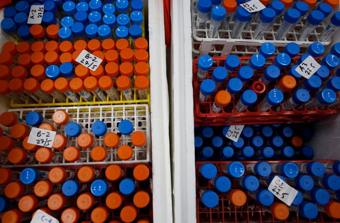 Amostras de testes de casos suspeitos de coronavírus COVID-19 (Foto: GIL COHEN-MAGEN / AFP)