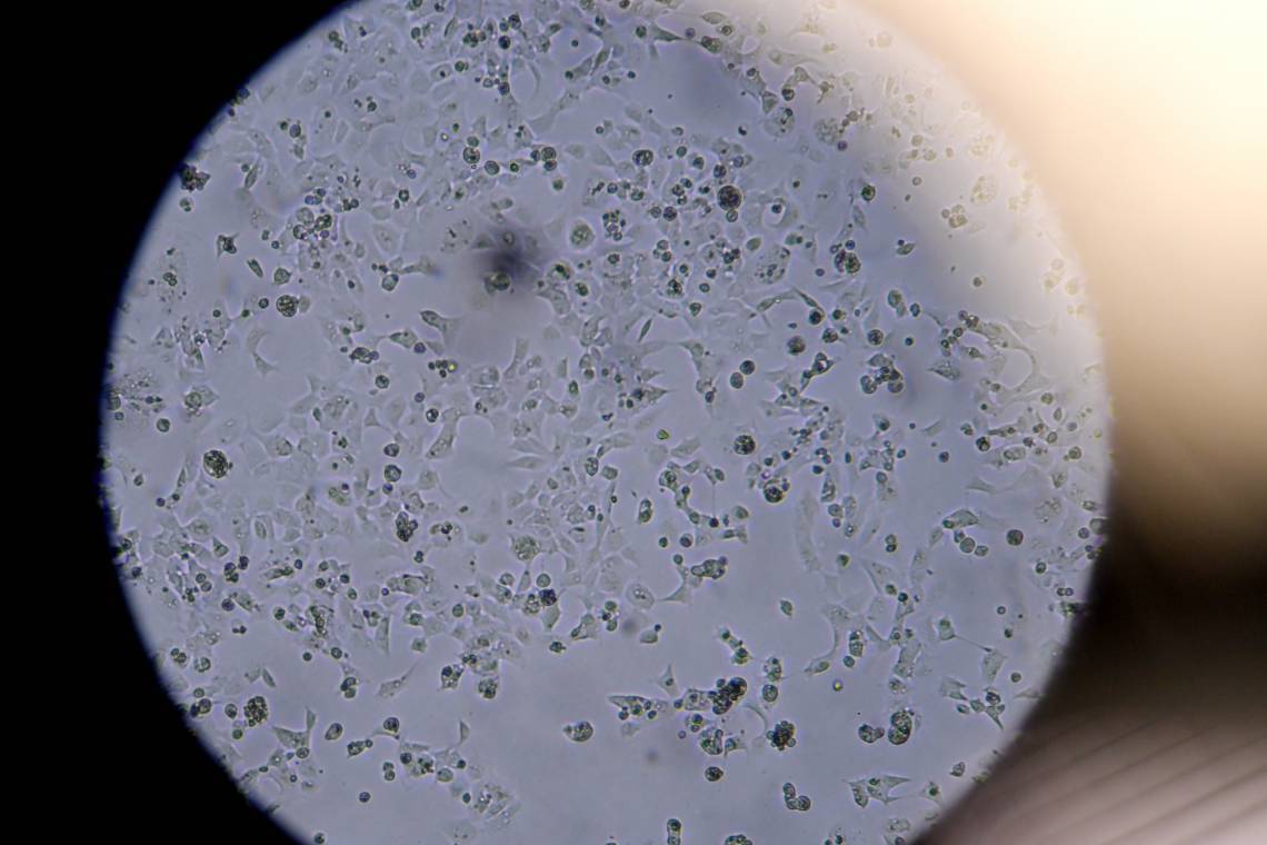 As células que contêm o novo coronavírus SARS-CoV-2 são vistas através de um microscópio no laboratório Stabilitech em Burgess Hill, sudeste da Inglaterra, onde os cientistas estão tentando desenvolver uma vacina oral para a COVID-19(Foto: BEN STANSALL / AFP)