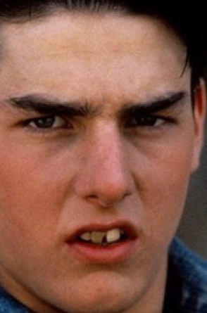O ator fez uma série de tratamentos para corrigir os problemas nos dentes(Foto: Reprodução)