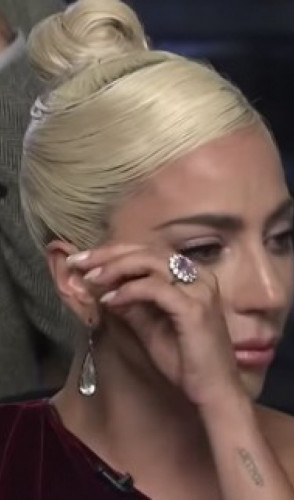 Famosos como Lady Gaga fazem parte dos cerca de 2,5% da população mundial que sofrem de fibromialgia.