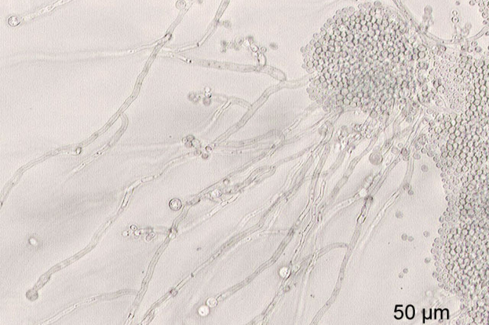 A cândida é uma das doenças humanas causadas por fungo.(Foto: Y tambe / Wikicommons)