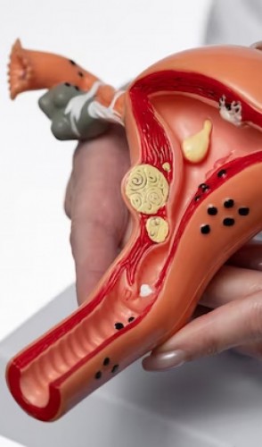 A laqueadura pode ser solicitada pelo SUS. Planos de saúde também devem oferecer o serviço. 