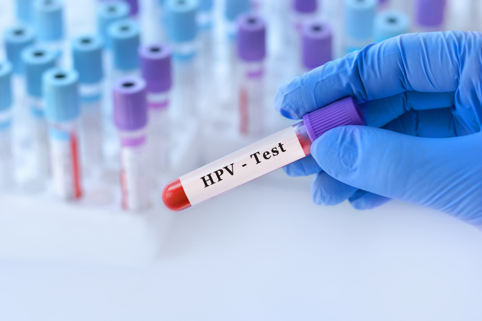 Tubo de amostra de sangue com teste de HPV e ao fundo de tubos de exames médicos com análises(Foto: Sukhina Marina / Adobe Stock)