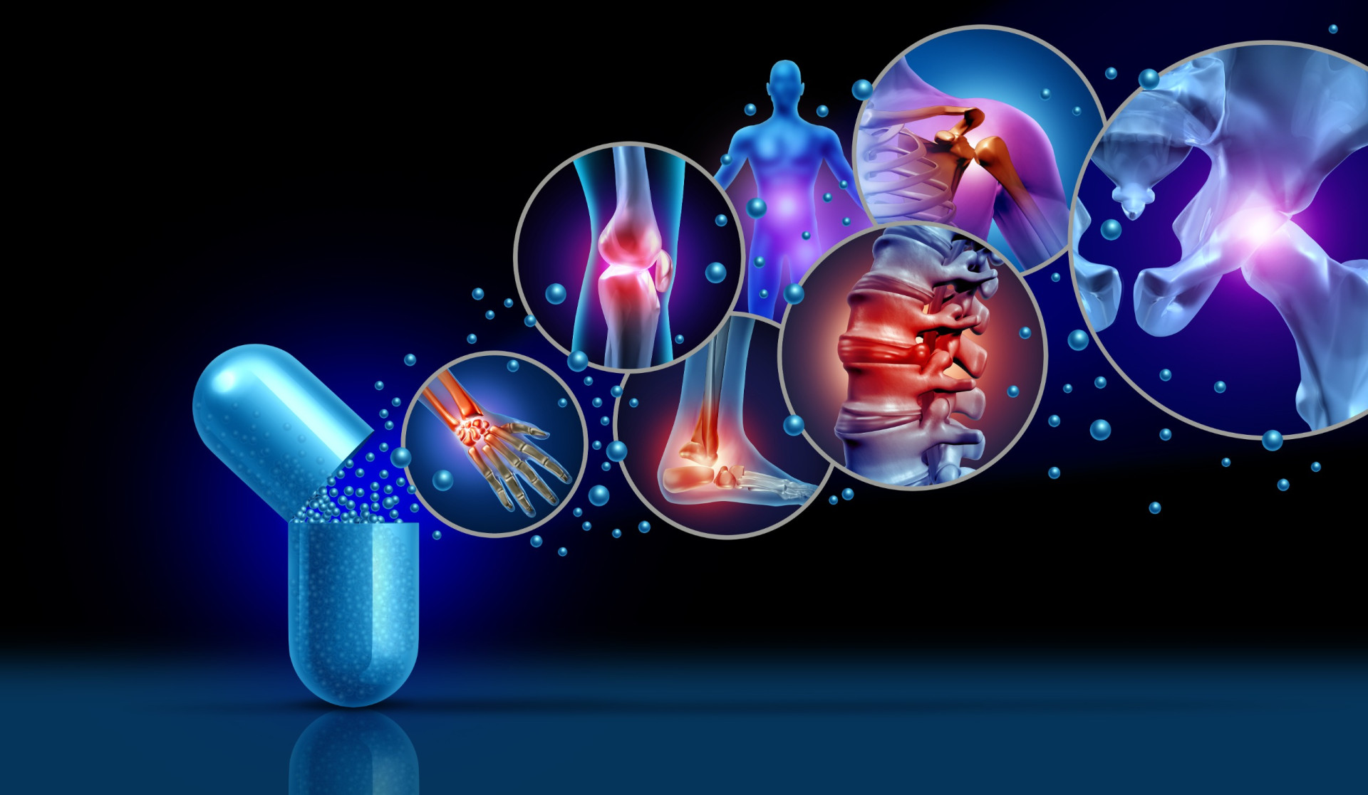 Fibromialgia é a segunda doença reumatológica crônica mais comum do Brasil  (Foto: Divulgação Adobe Stock)