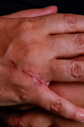 CAPA - MARCAS DO FEMINICÍDIO