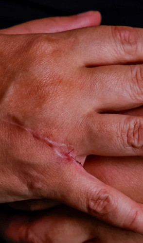 Imagem da reportagem: As dores do feminicídio que não aparecem nas estatísticas