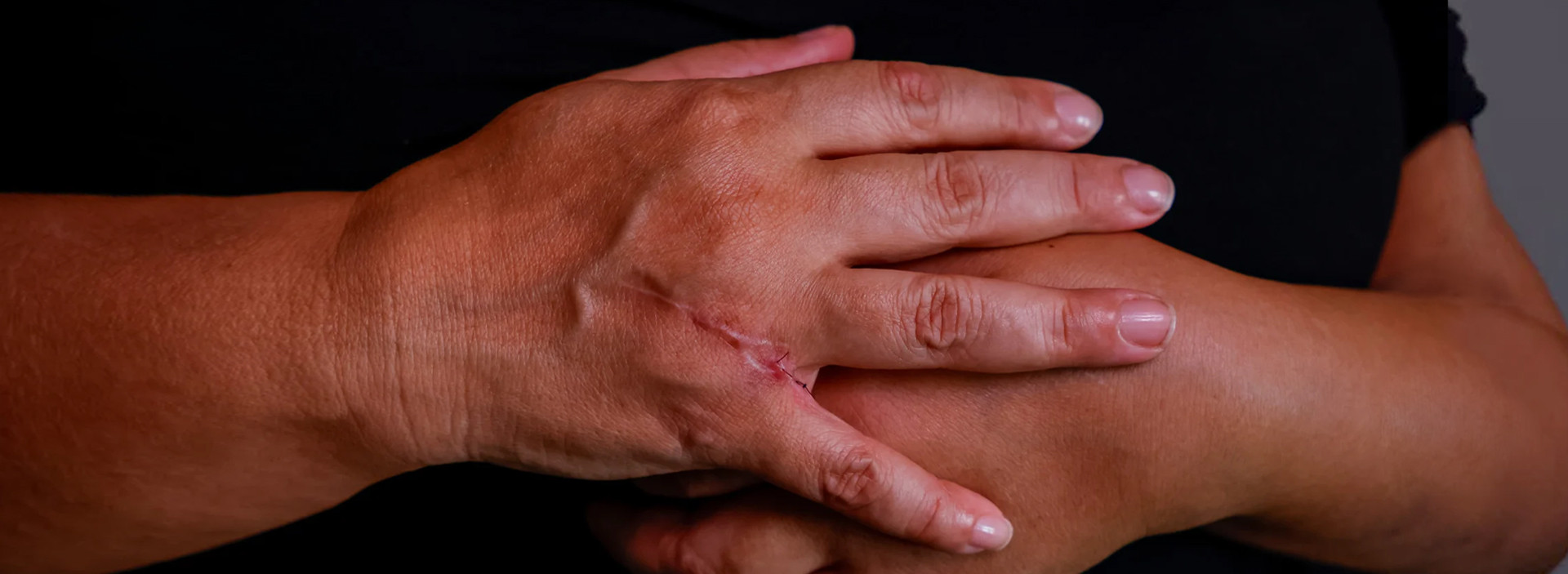 As marcas da viol&ecirc;ncia no cotidiano das mulheres (Foto: AUR&Eacute;LIO ALVES)