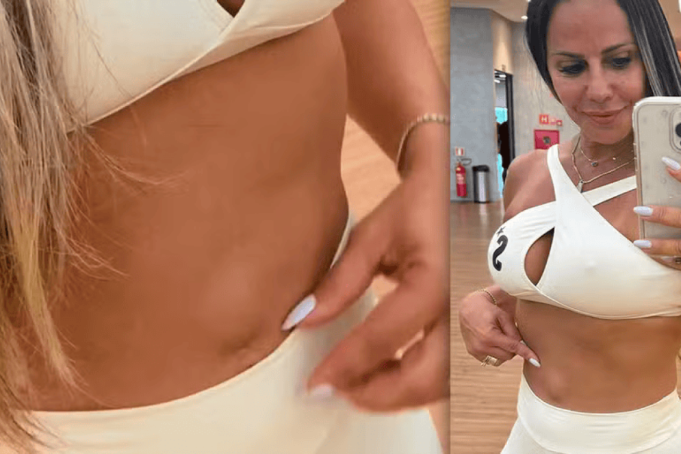 A atriz, dançarina e modelo Viviane Araújo já mostrou diversas vezes a hérnia umbilical que possui em seu abdômen. Ela já passou por três procedimentos cirúrgicos, inclusive após a gravidez do filho Joaquim, de 2 anos(Foto: Reprodução/Instagram)